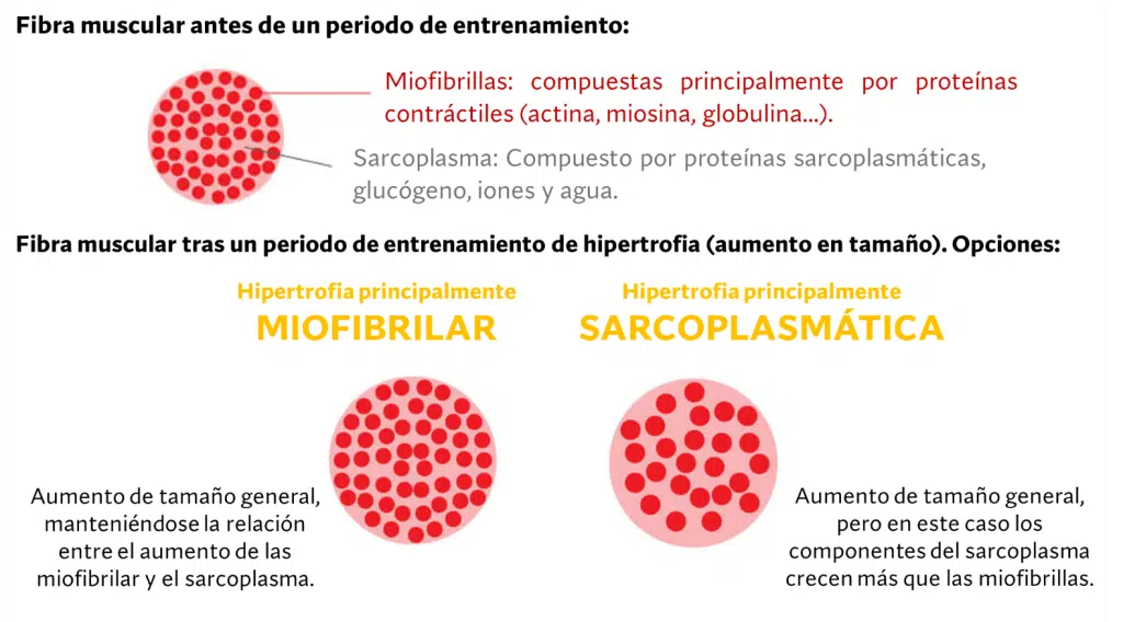 Hipertrofia sarcomérica
