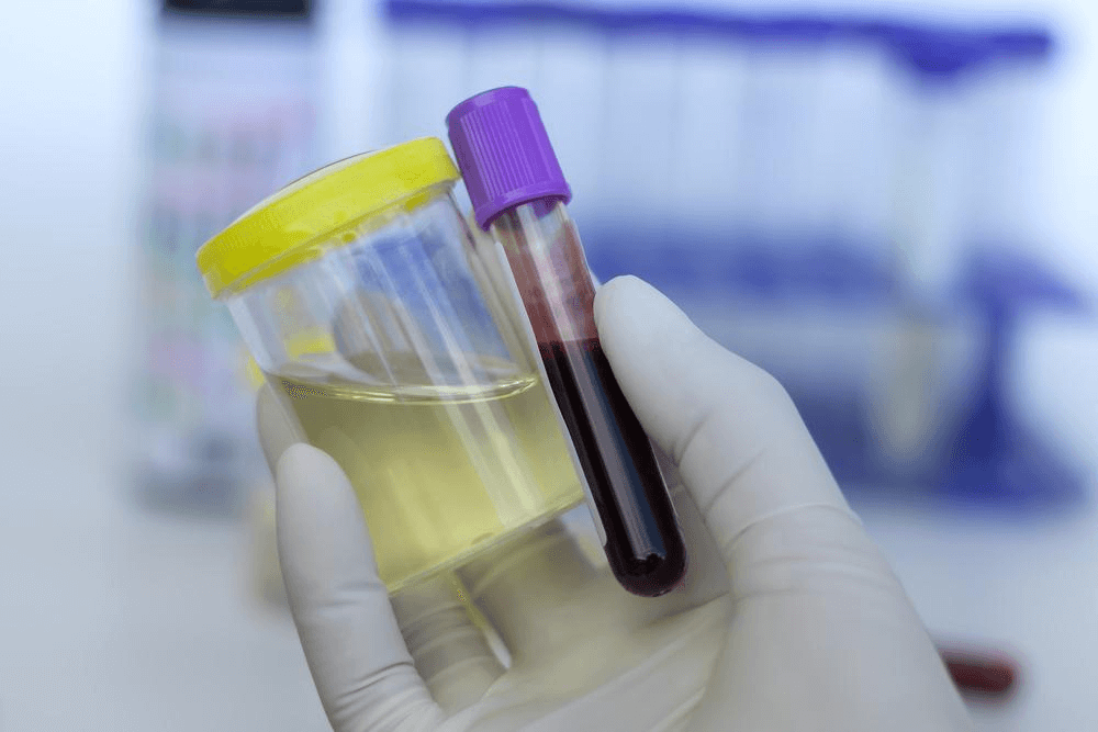 ¿Son fiables los test antidoping en culturismo?