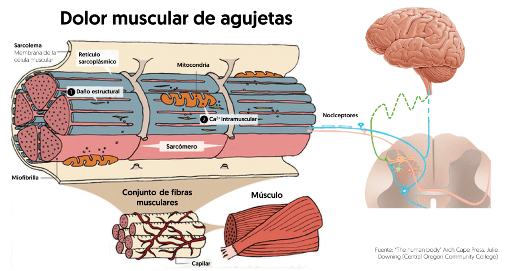 Mecanismo fisiológico del dolor muscular
